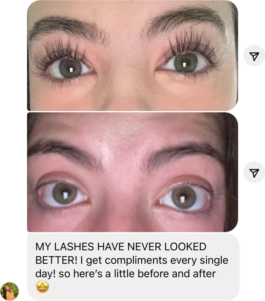 NATURA LASHES - WIMPERSERUM - LASH SERUM - EYELASH GROWTH SERUM - ECHTE RESULTATEN - TOT 55% LANGER EN 75% VOLUMINEUZER OGENDE WIMPERS - Afbeelding 3