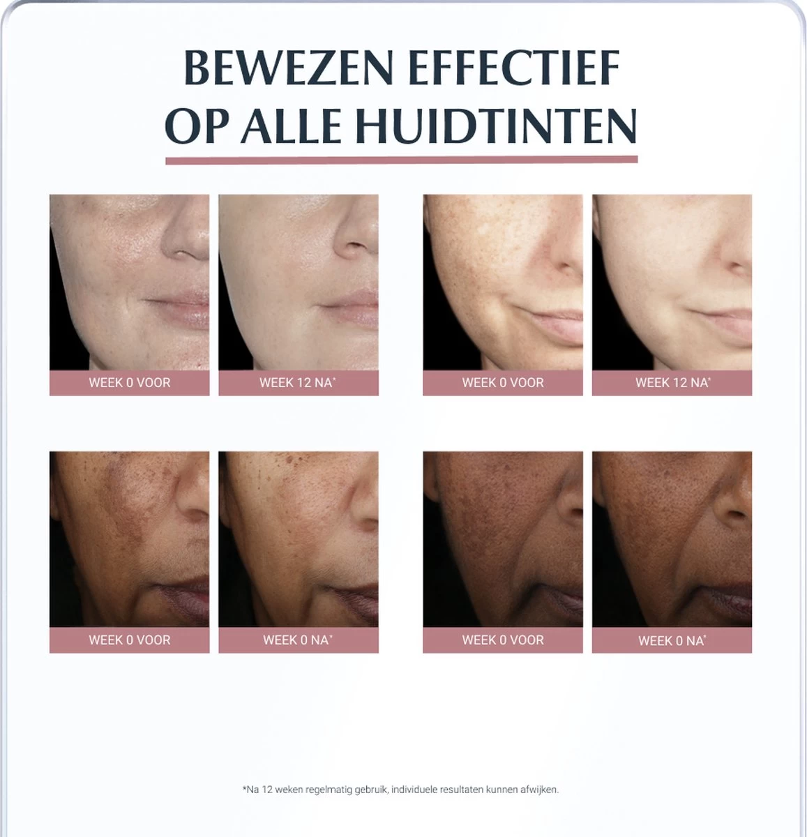 Eucerin Anti-Pigment Spotcorrector - Concealer - 5 Ml - Afbeelding 6