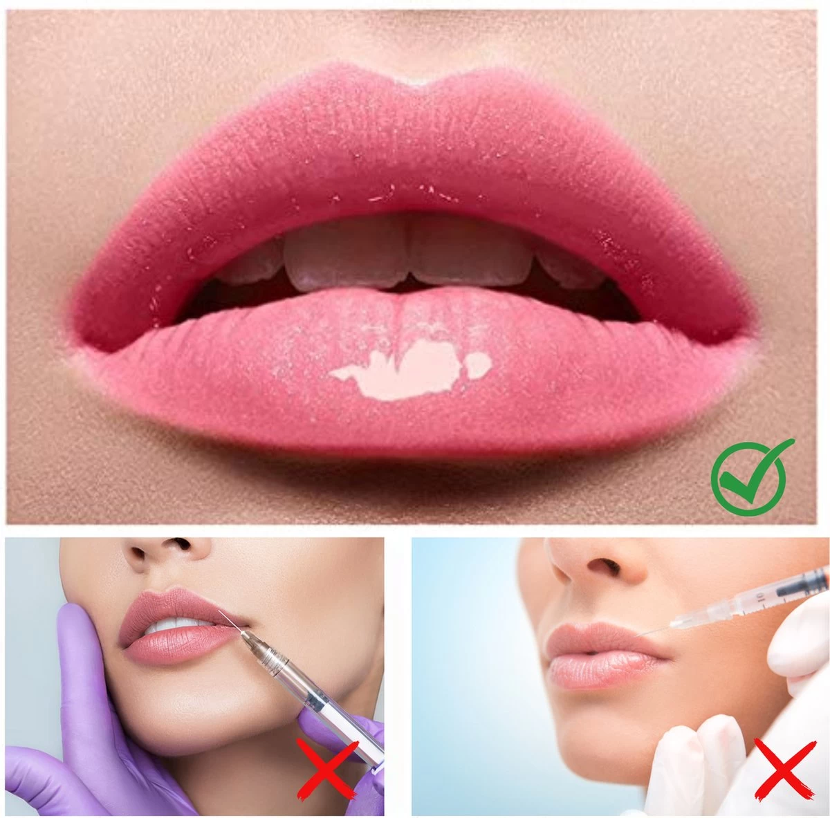 Bellive Instant Effects Lip Plumper - Natuurlijke Lip Plumper - Lip Maximizer - Cadeau - Lip Gloss - Lip Care - Full Lips - Lip Plumper Lip Gloss - Herstellende Lippen - Lip Maximizer - Afbeelding 5